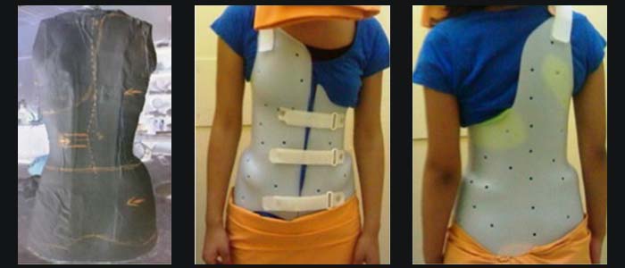 brace